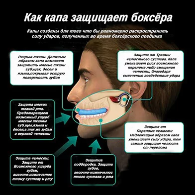 Реальное фото Капа одночелюстная боксерская от магазина Спортев